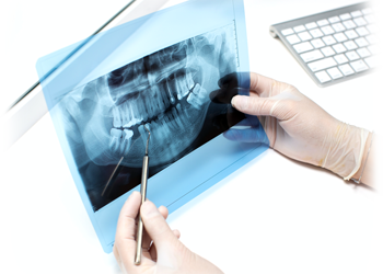 Odontólogos alemanes descubren nuevo implante dental